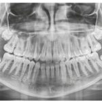 ¡Llega “Nuestro Mundial de Futsal” a Mérida!